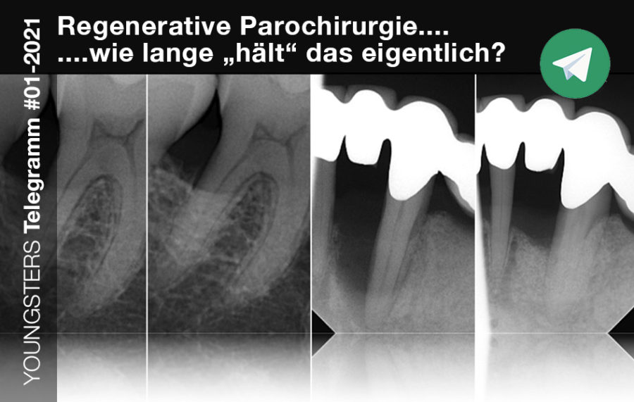 Regenerative Parochirurgie – Wie lange „hält“ das eigentlich…?
